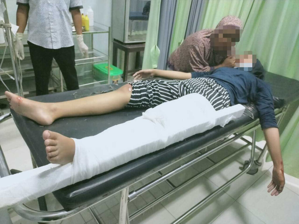 HP Dijambret di Atas Motor, Korban Terjatuh Hingga Alami Patah Tulang