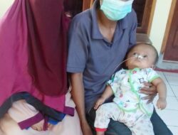 Hafizah Bocah 9 Bulan Penderita Hydrocephalus Mendapat Bantuan dari Gubernur dan Direktur RSUD NTB