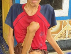 Rachmat Hidayat Bantu Pemuda Penderita Lumpuh Layu di Gerung